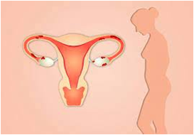 قصور المبيض