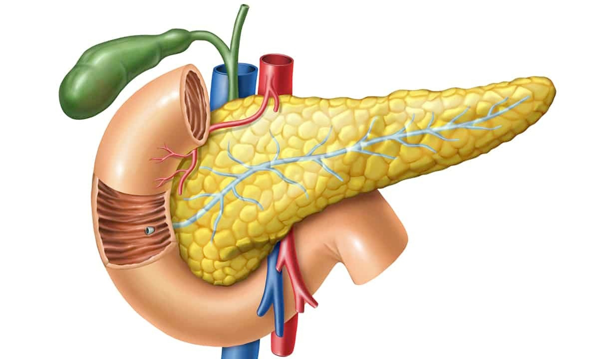 التهاب البنكرياس الحاد