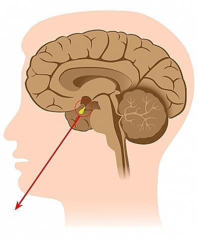 ورم الغدة النخامية