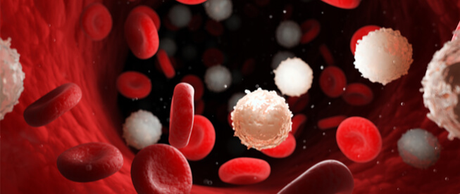 الورم الليمفي البلازماوي