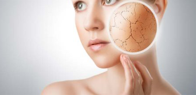 جفاف الجلد المصطبغ