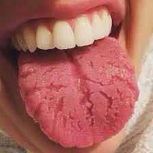 8CF38779-7744-4AF1-9D8A-D6F66D6AB96E