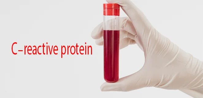 تحليل البروتين التفاعلي سي