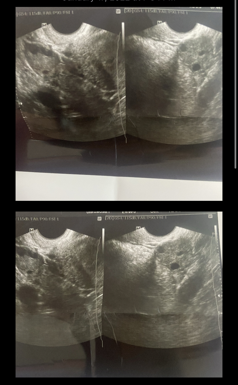 253B308D-E4AD-4A6C-ABC6-87A33DA653E6