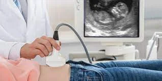 الشفافية القفوية