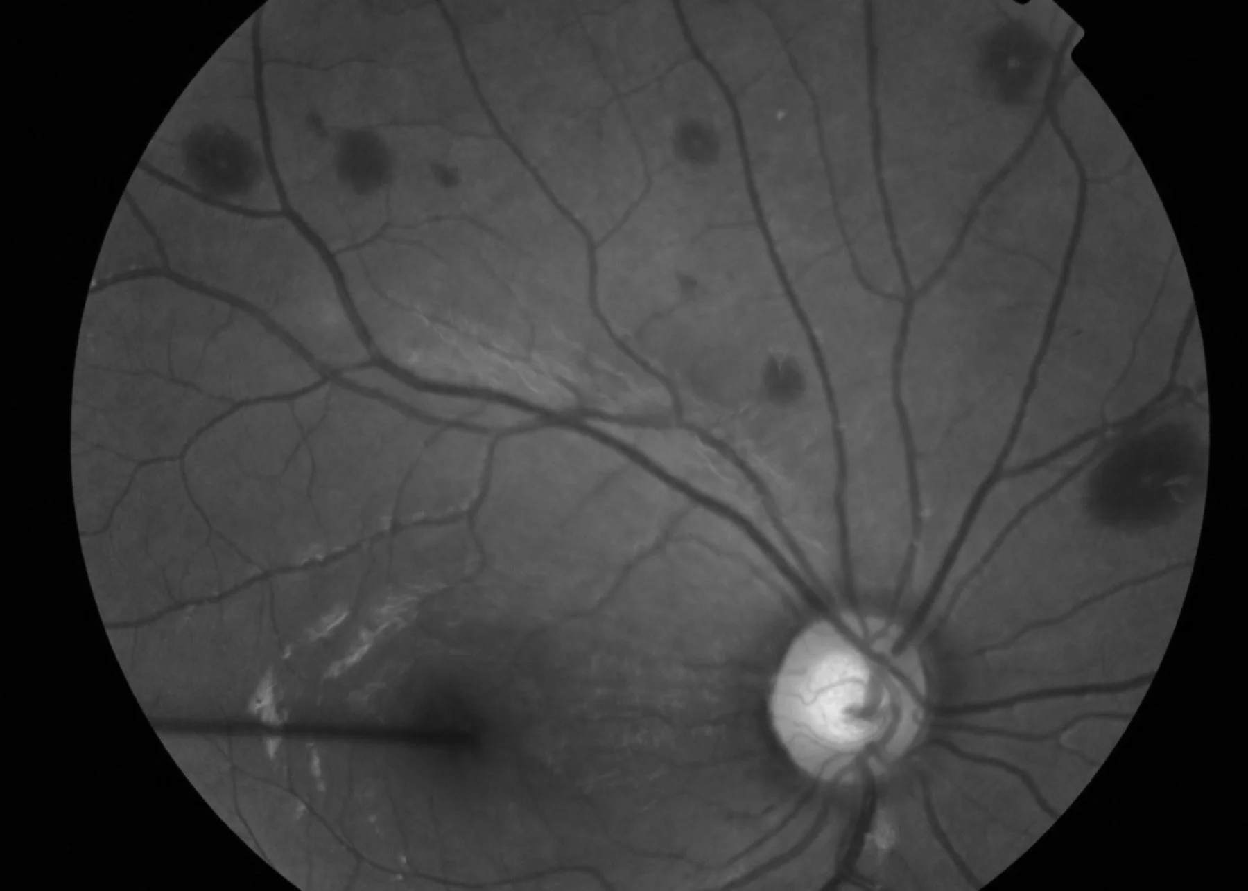 داء تاكاياسو