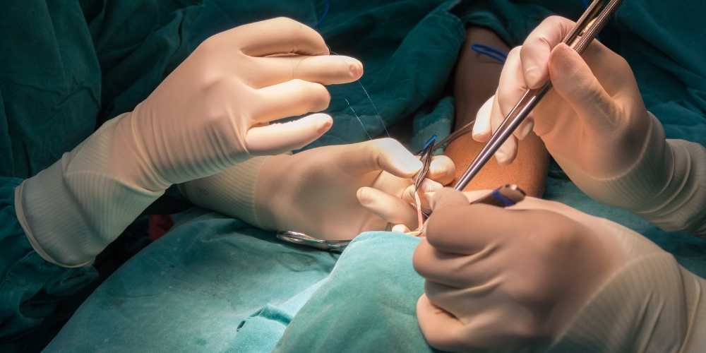 بضع الناسور