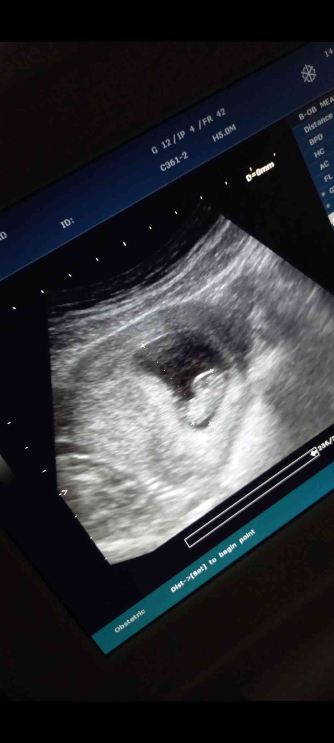 752a8005-7d33-4100-b1a5-e4f9f978b27a