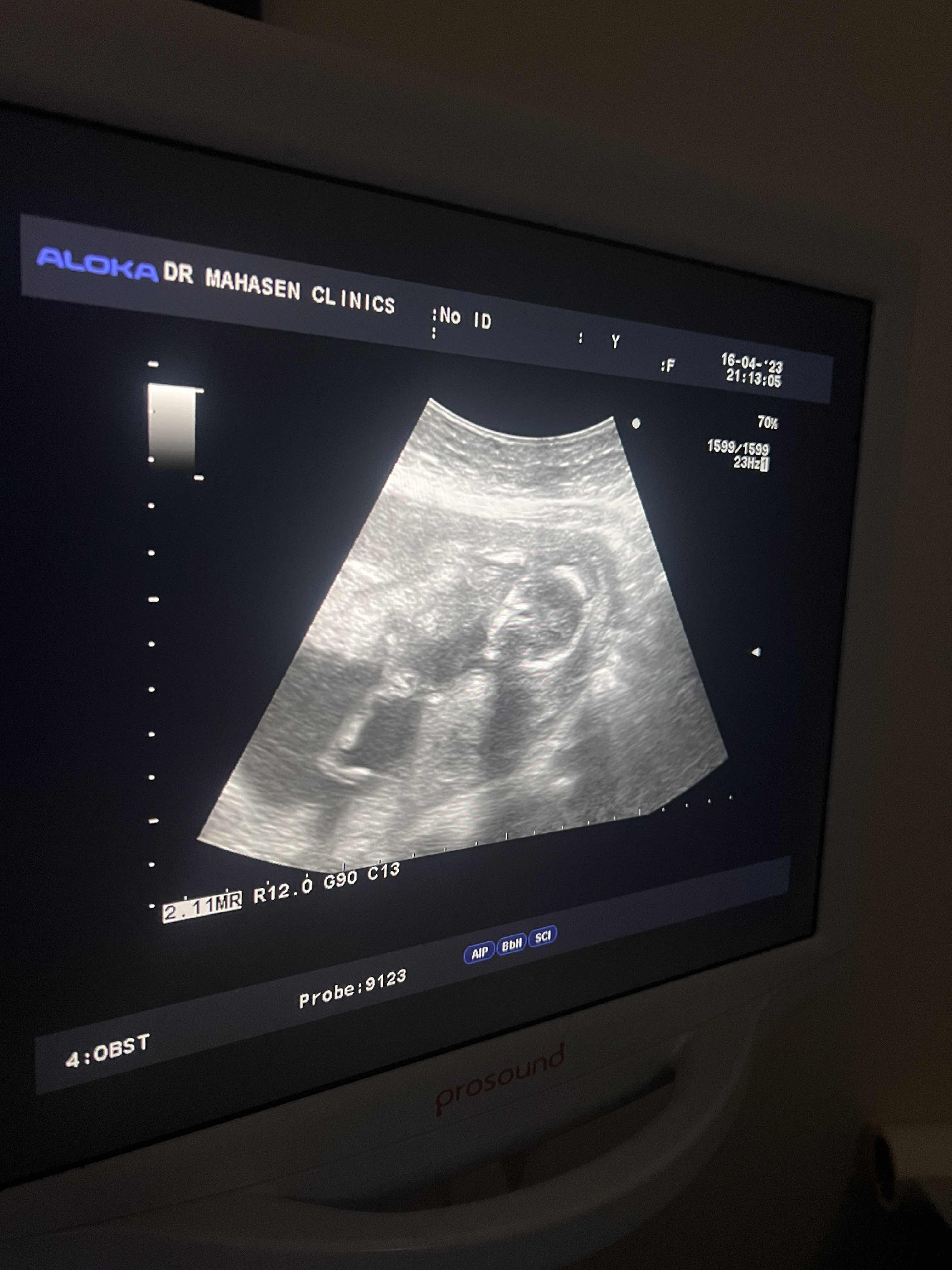 ACFF5A06-E524-4C8C-9339-7B3DE2EB20EF