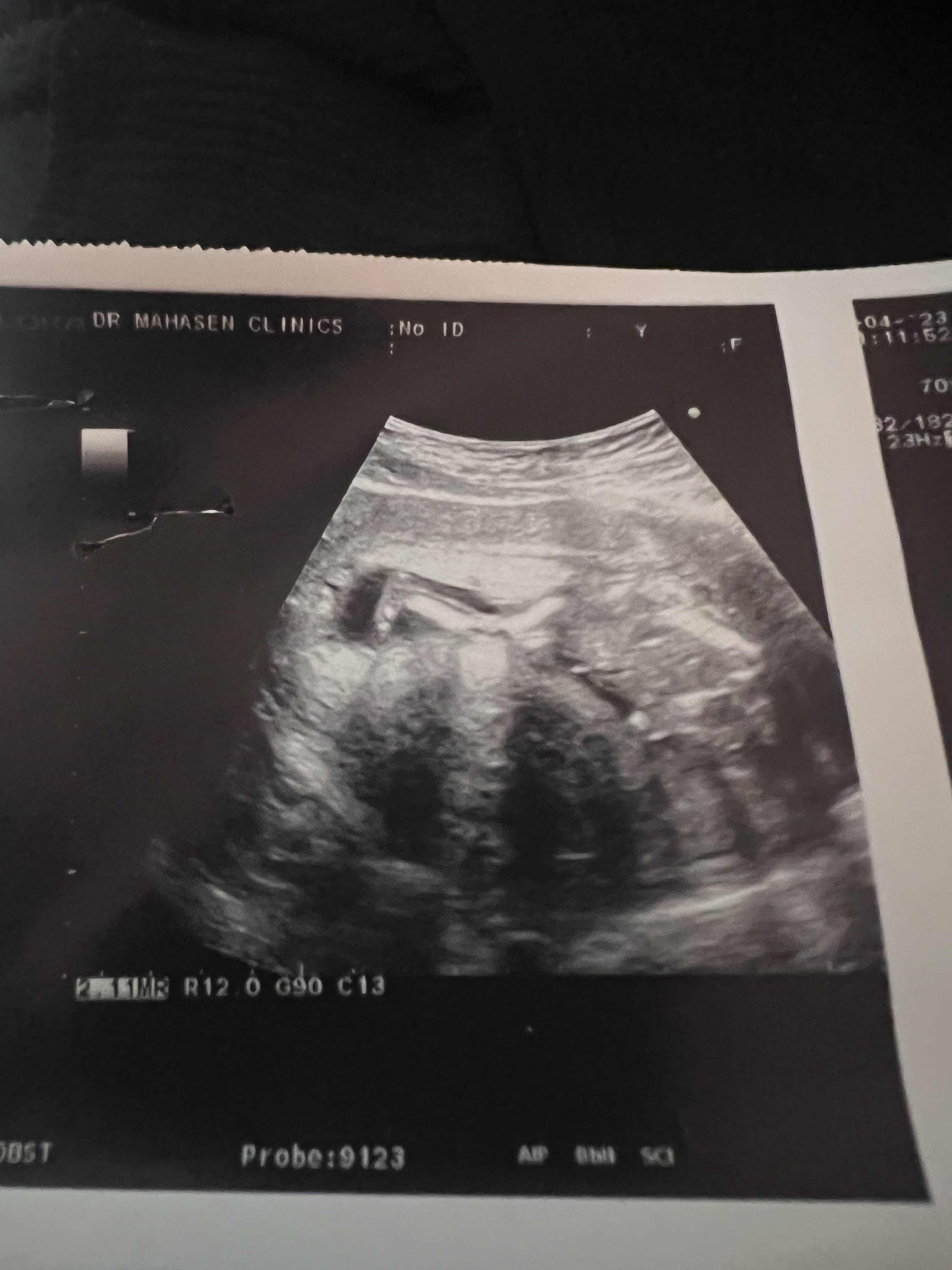 58D4109A-20BC-42C0-8677-7F909FD430CD