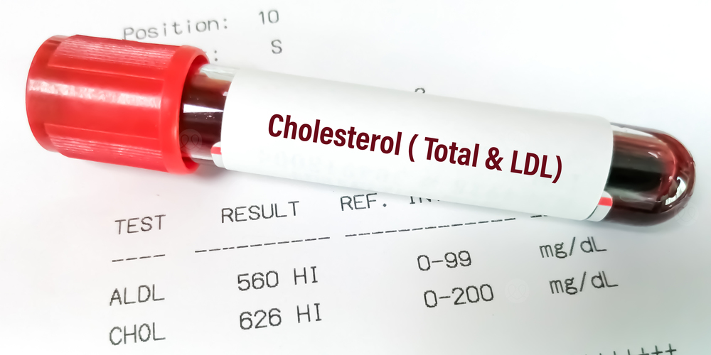 الكوليسترول الضار