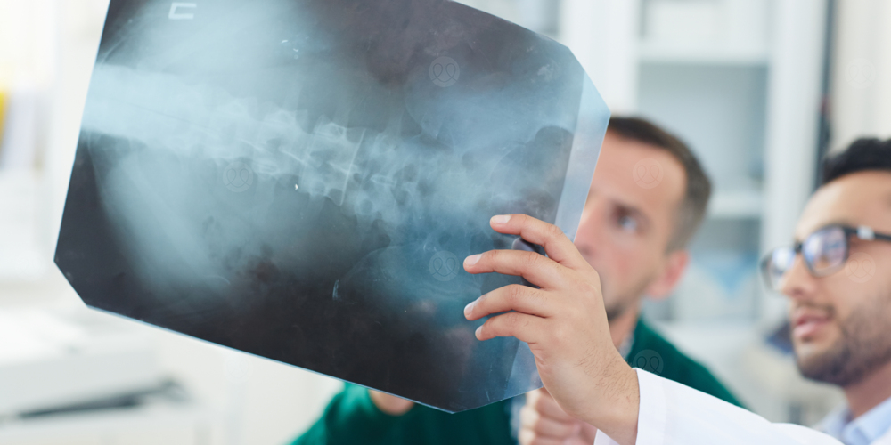 كسر انضغاطي