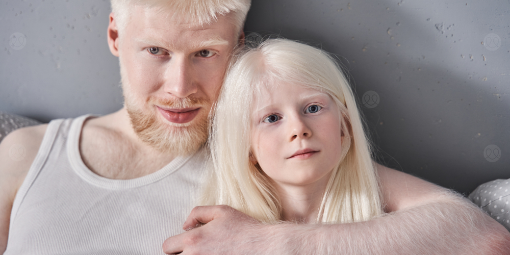 متلازمة تشيدياق هيغاشي