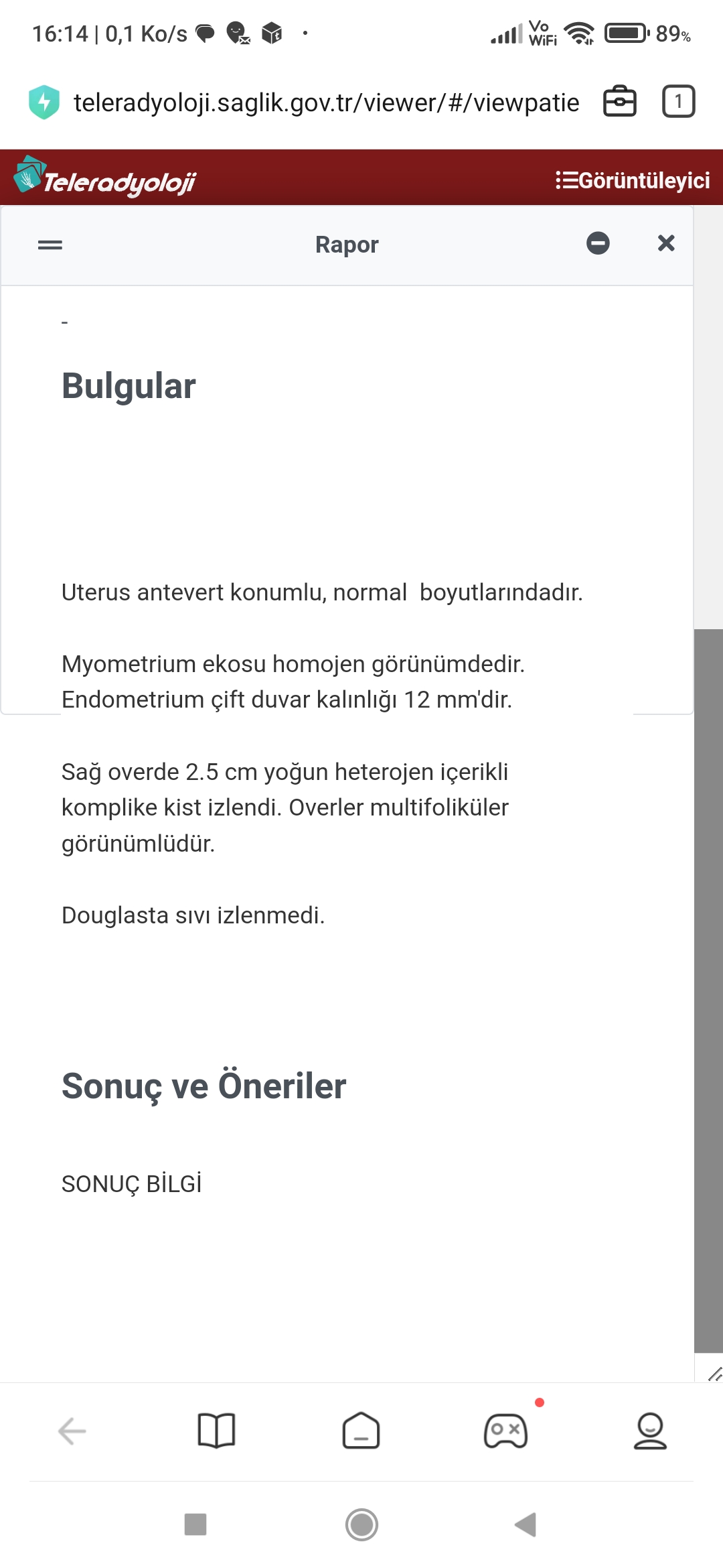 Screenshot_2023-11-07-16-14-09-198_com.mi.globalbrowser
