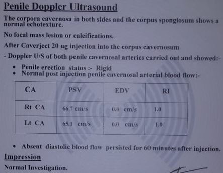 Penile Dopple Ultrasound