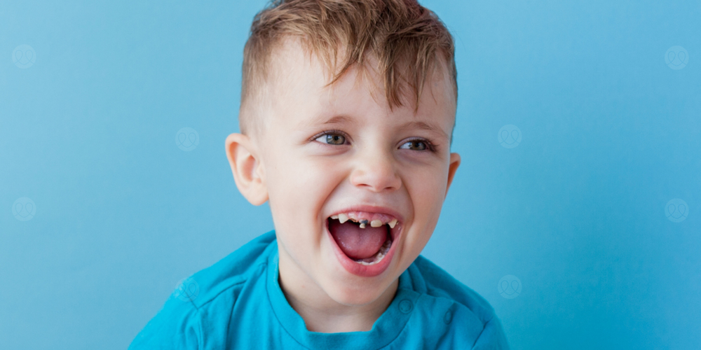 تسوس الاسنان