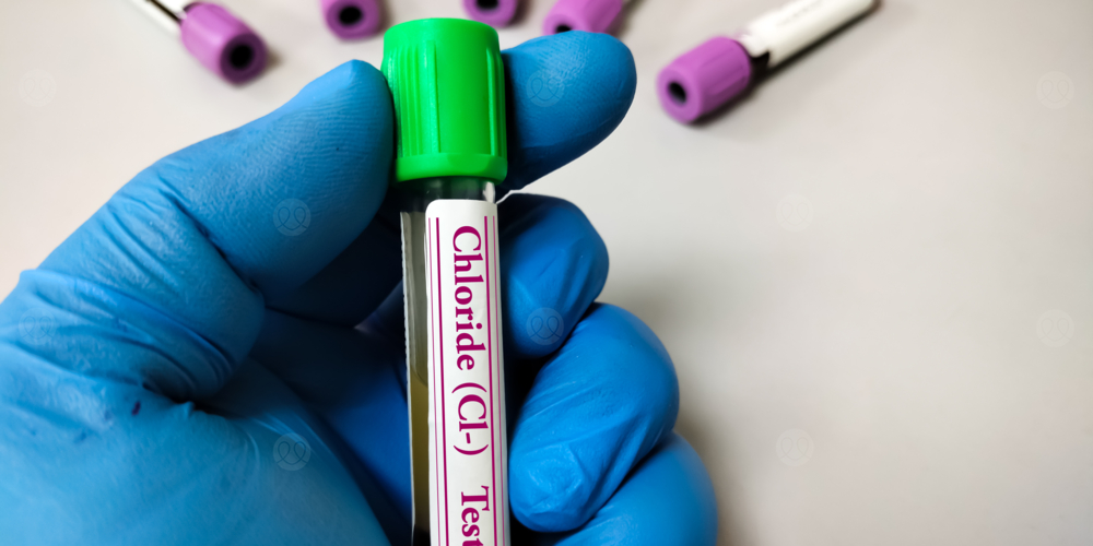 نقص كلوريد الدم