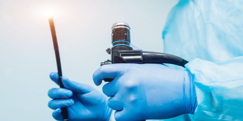 تنظير الحنجرة