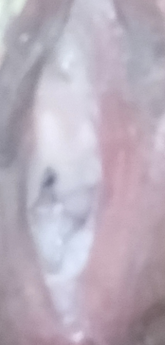 1710576452378