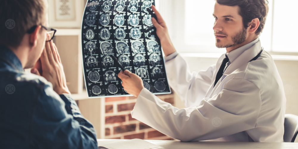 السكتة الدماغية الاقفارية