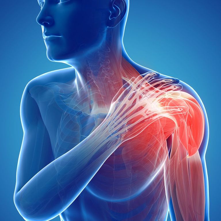 121-100530-causes-shoulder-pain-methods-treatment-2