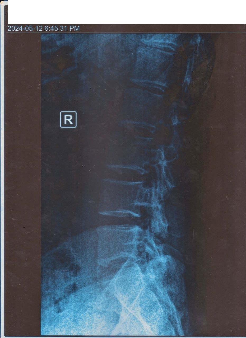 xray