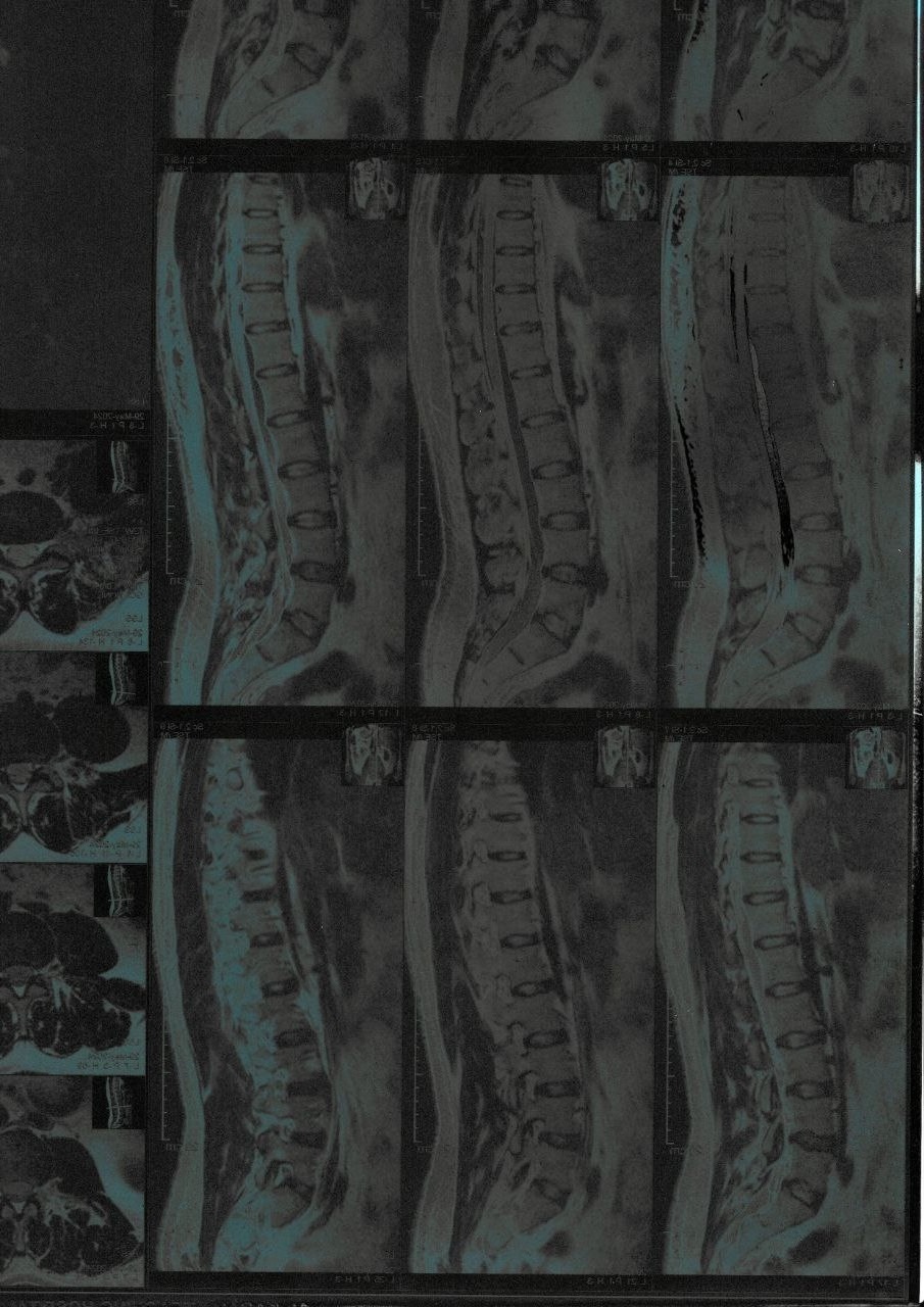mri