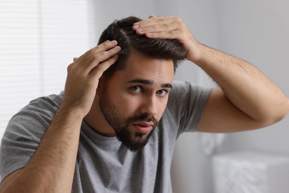 أنواع قشرة الشعر