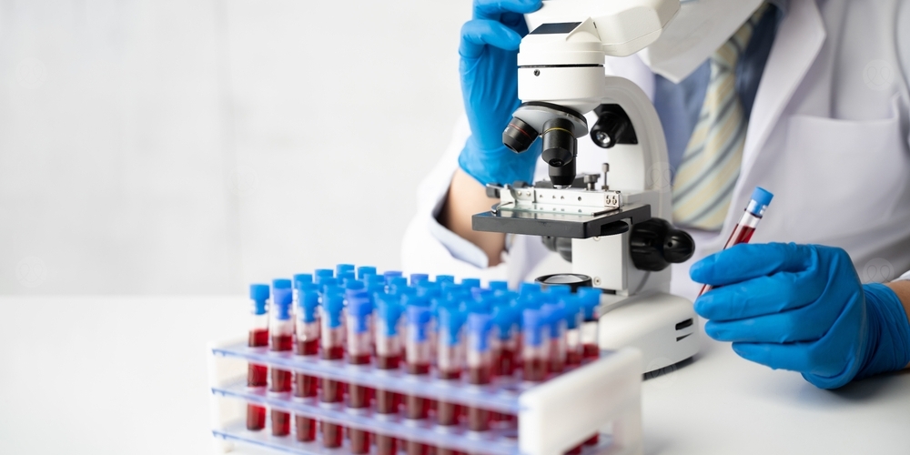 عدوى فيروس نيباه