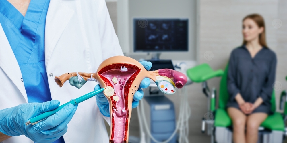 الاورام الليفية الرحمية