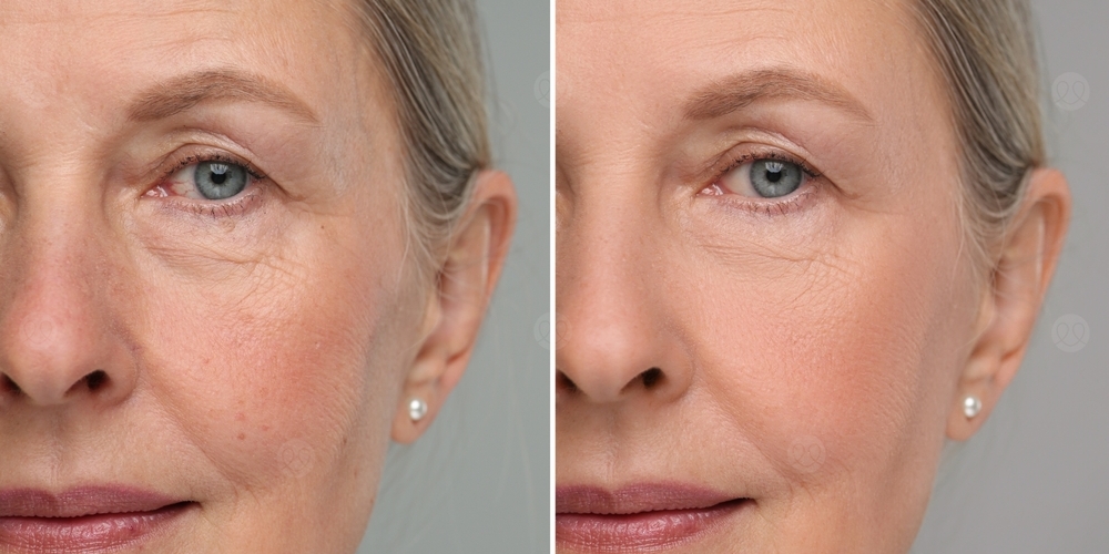 الشيخوخة الضوئية