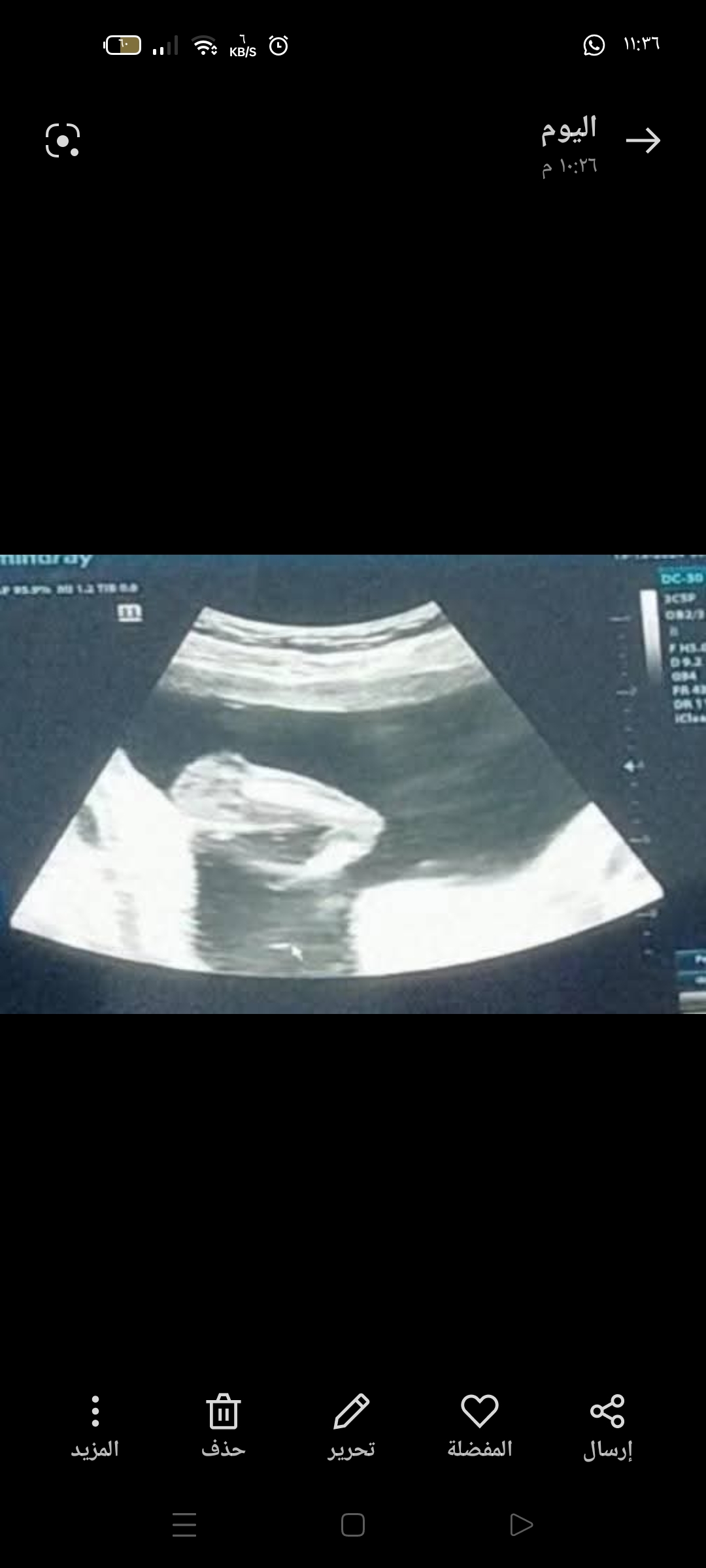 Screenshot_2024-12-13-23-36-18-62_99c04817c0de5652397fc8b56c3b3817