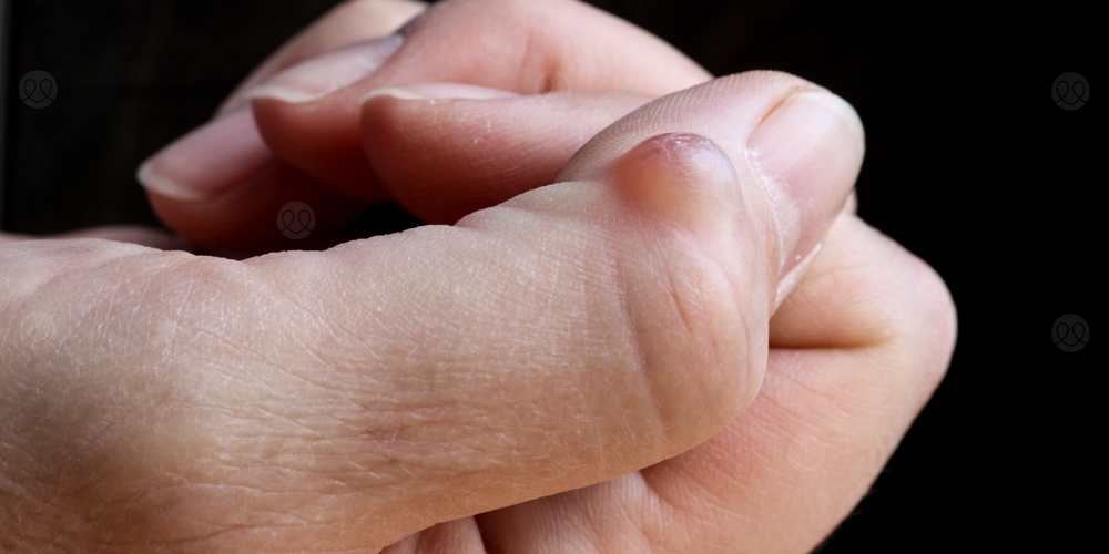 عقدة الاصبع