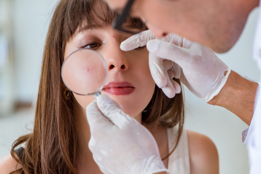 5. الثآليل الخيطية (Filiform Warts)