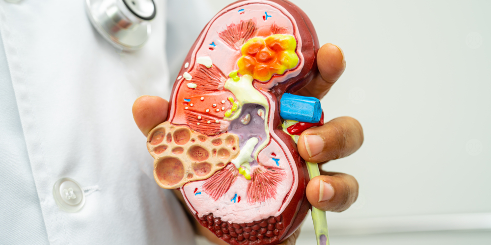 الفشل الكلوي المزمن