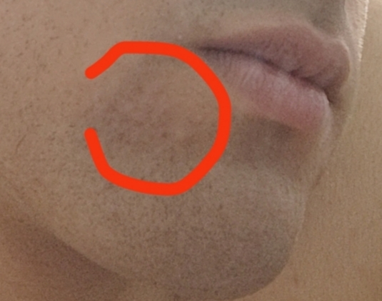 1001271232