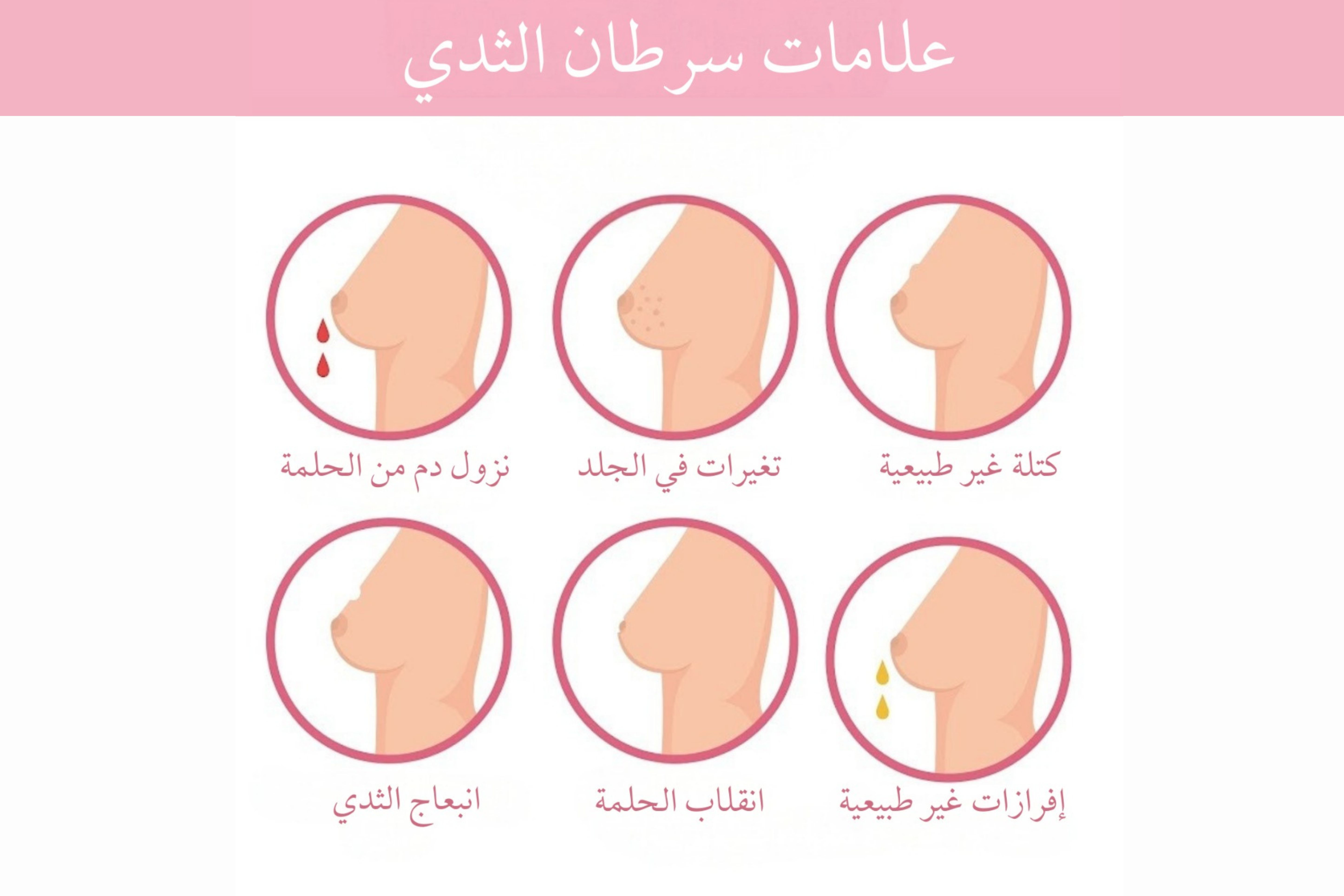 3. راقبي أي تغيرات طبيعية لشكل وحجم الثدي