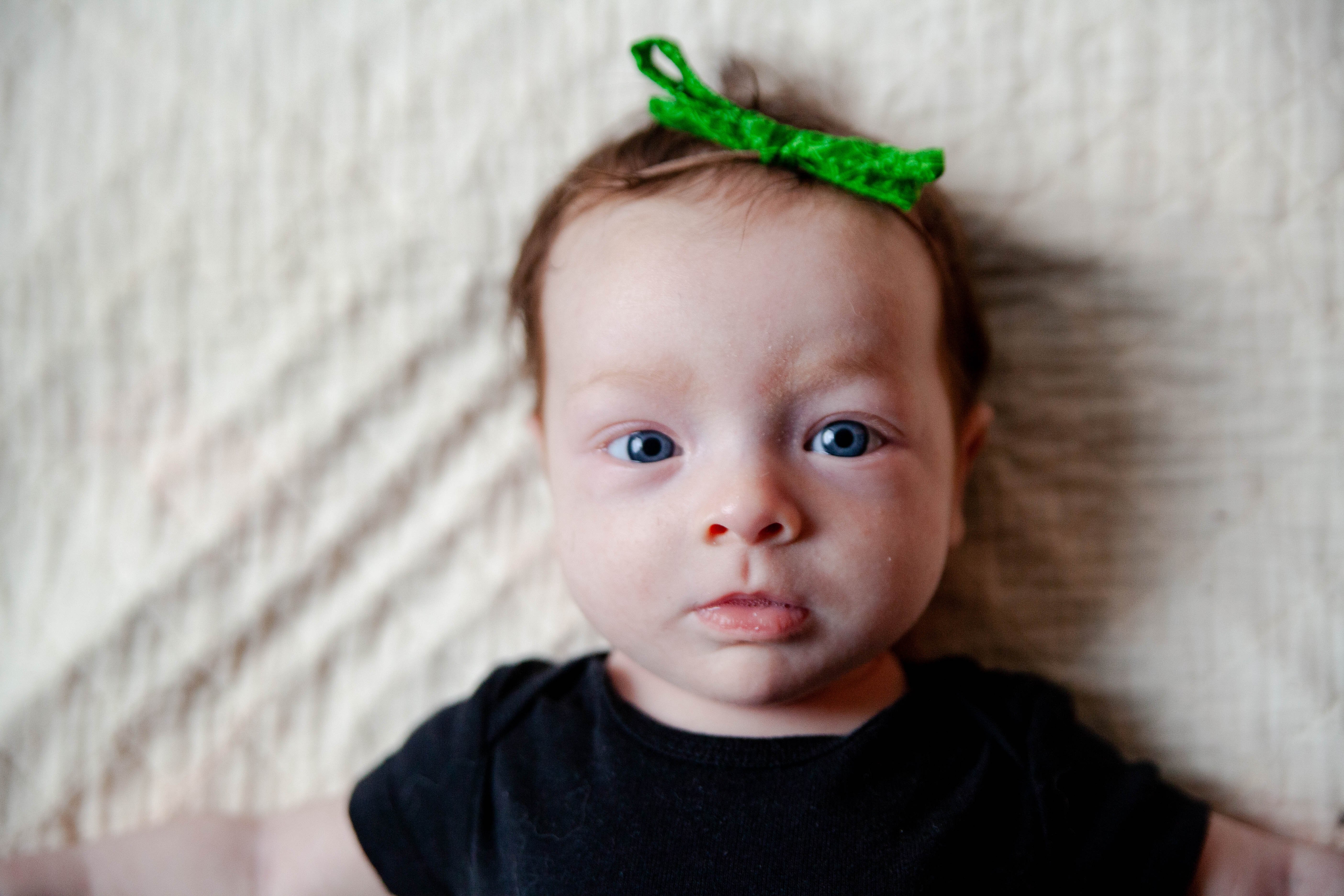 أعراض متلازمة نونان