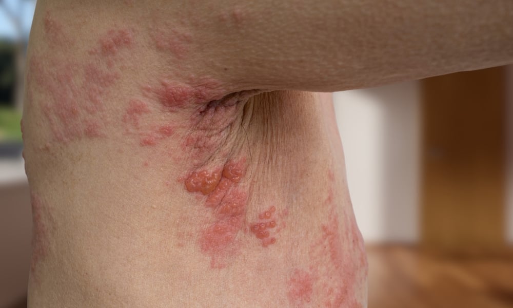 الحزام الناري: 6 أشكال تعرّف عليها بالصور