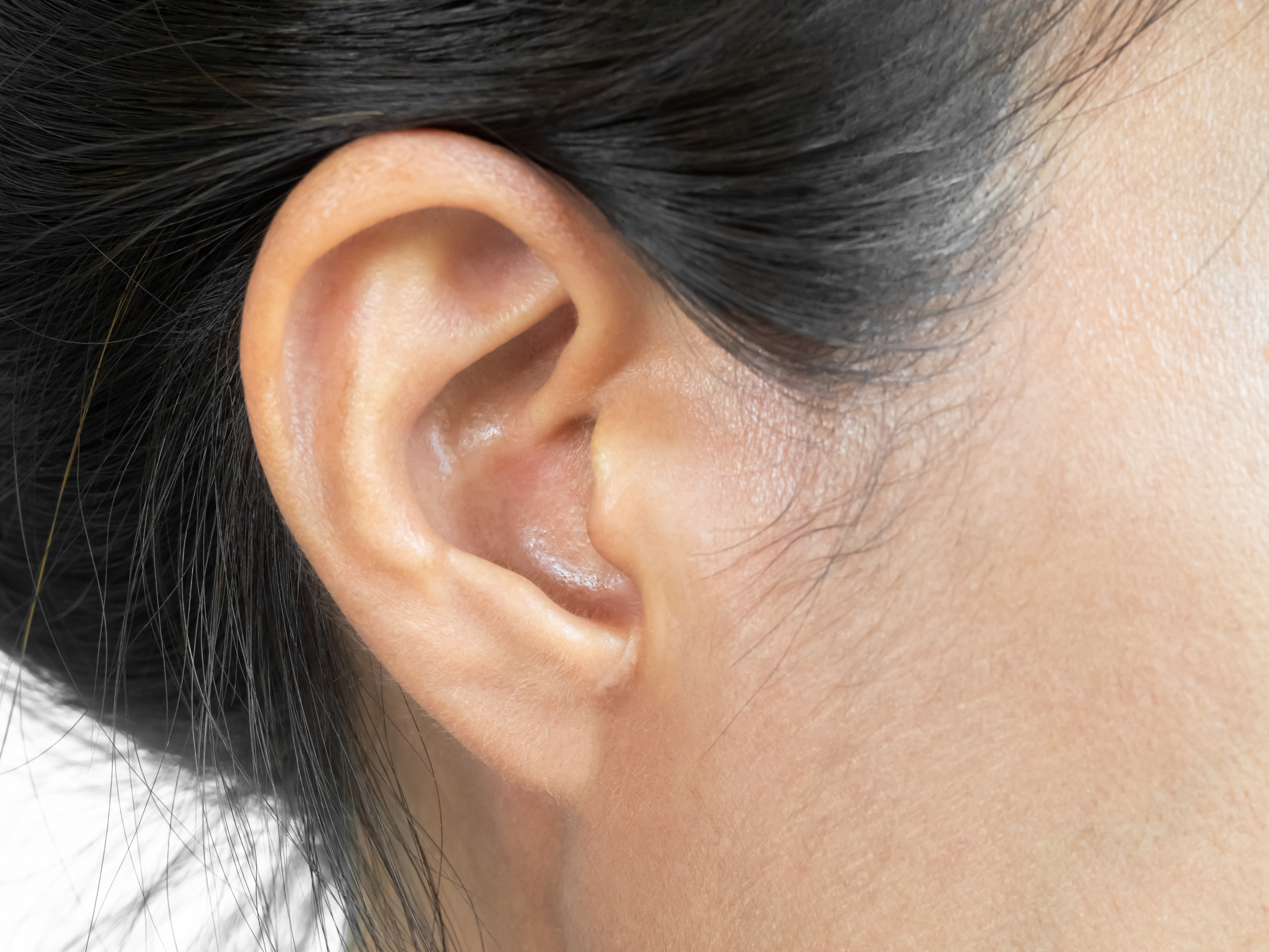 أنواع عمليات تجميل الأذن