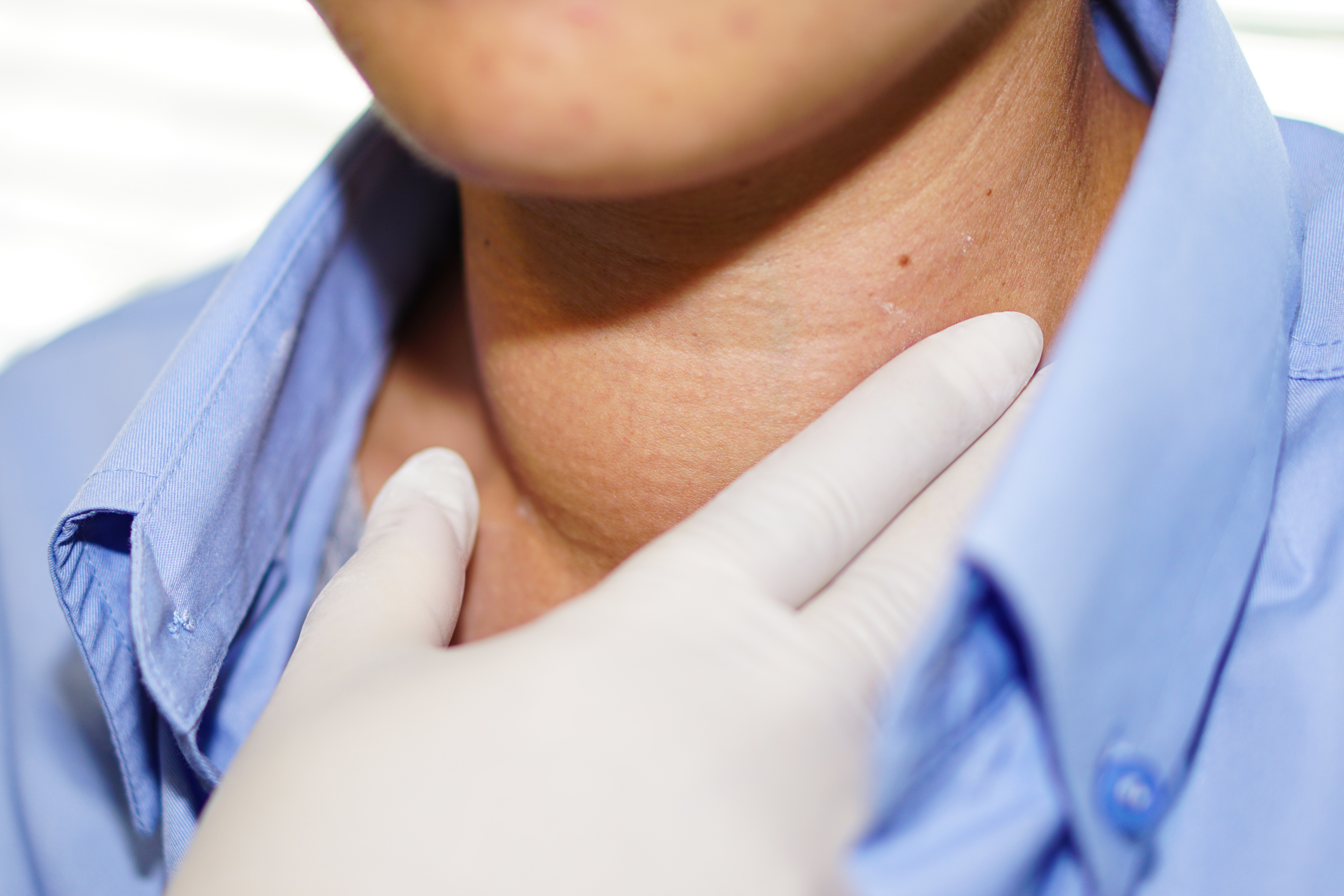 ما هو سرطان الرقبة؟