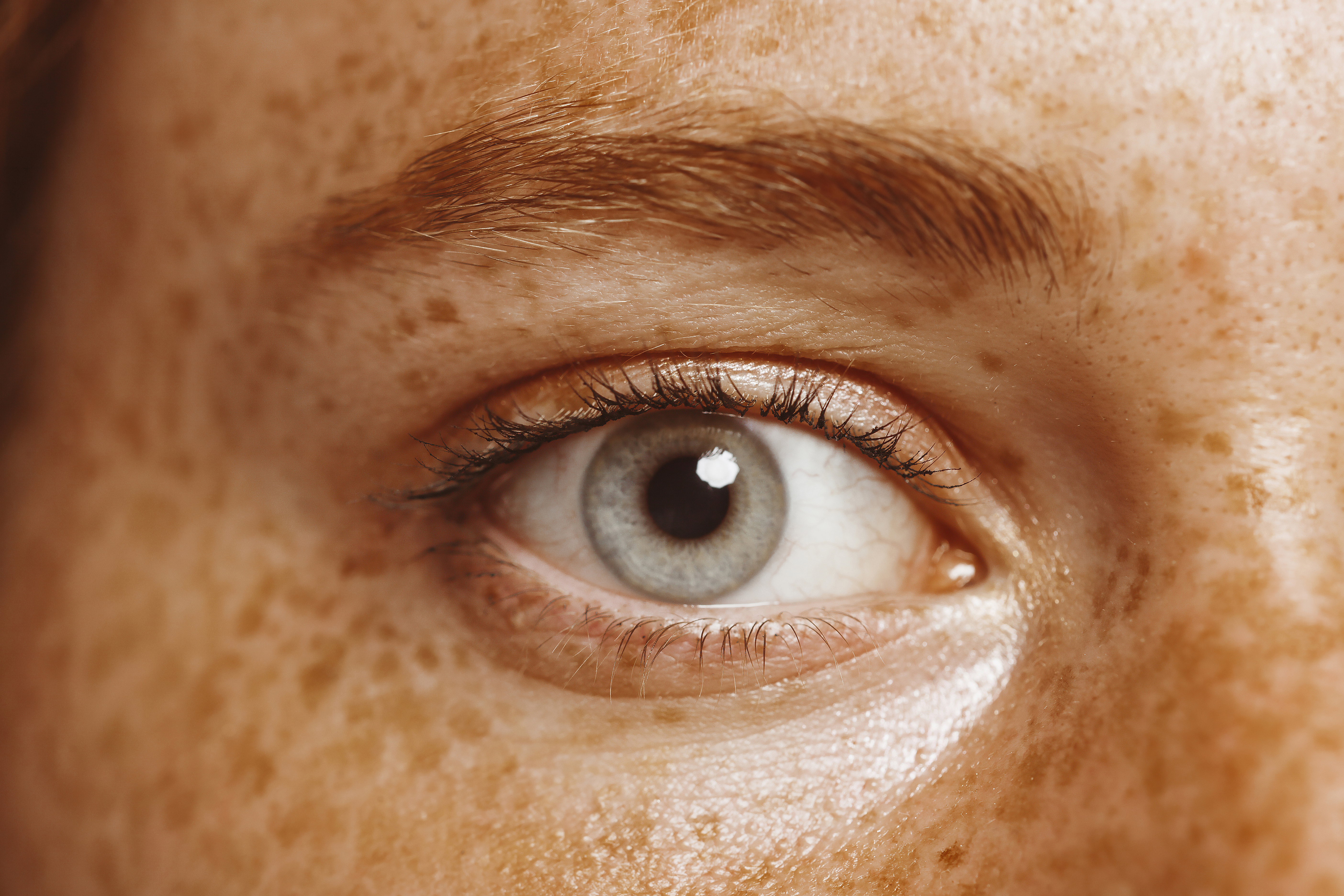 أسباب سرطان العين وعوامل الخطر