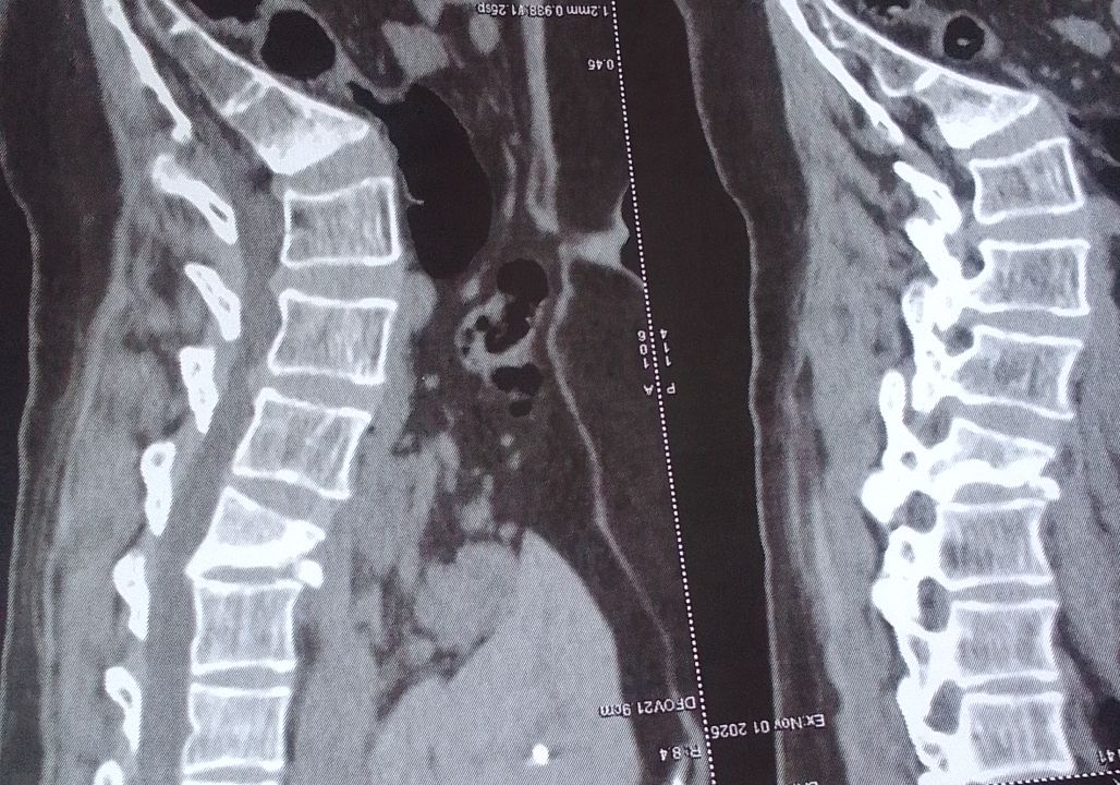 IMG_20251101_174044~2