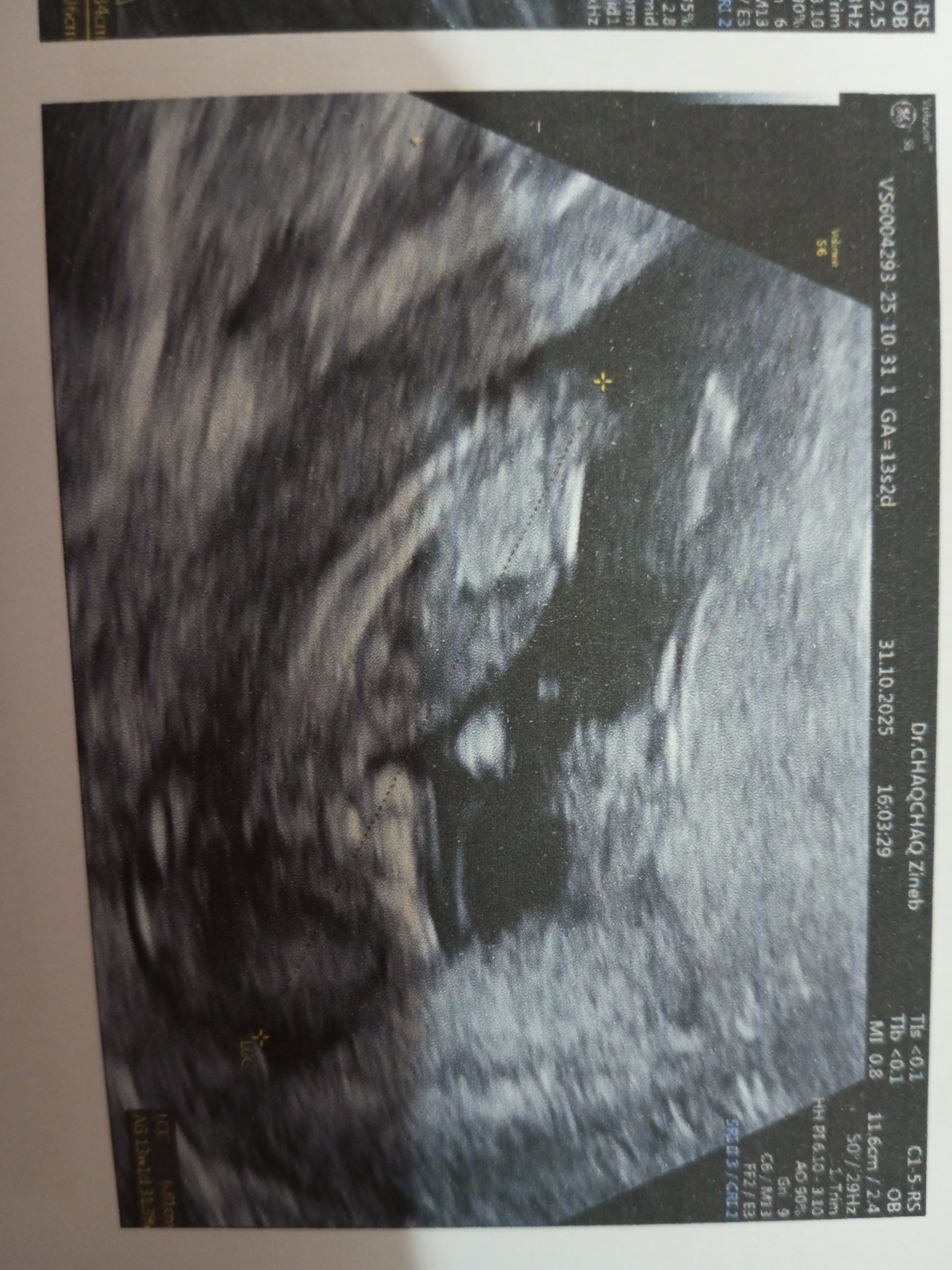 IMG_20251109_232622_956