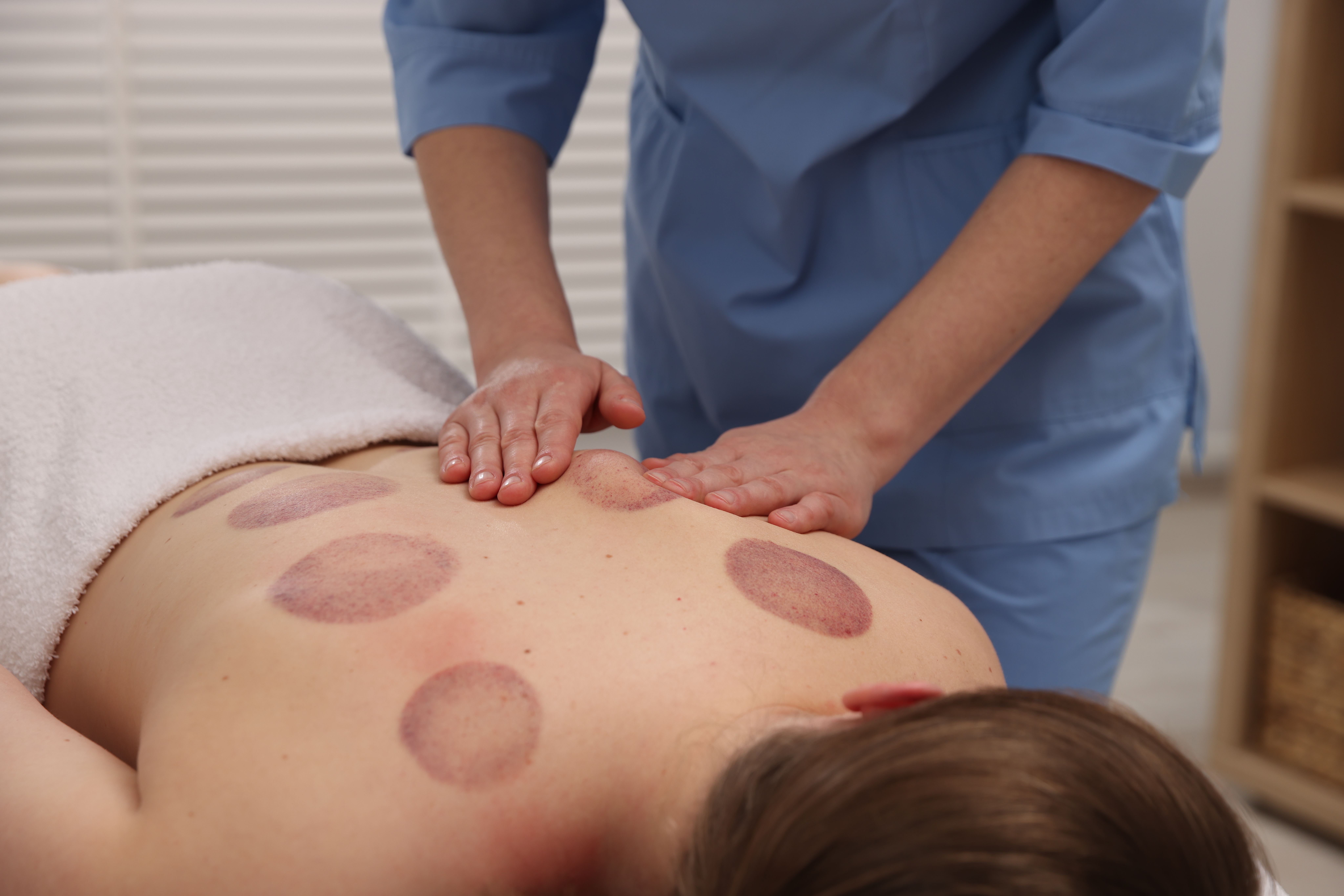 أضرار الحجامة