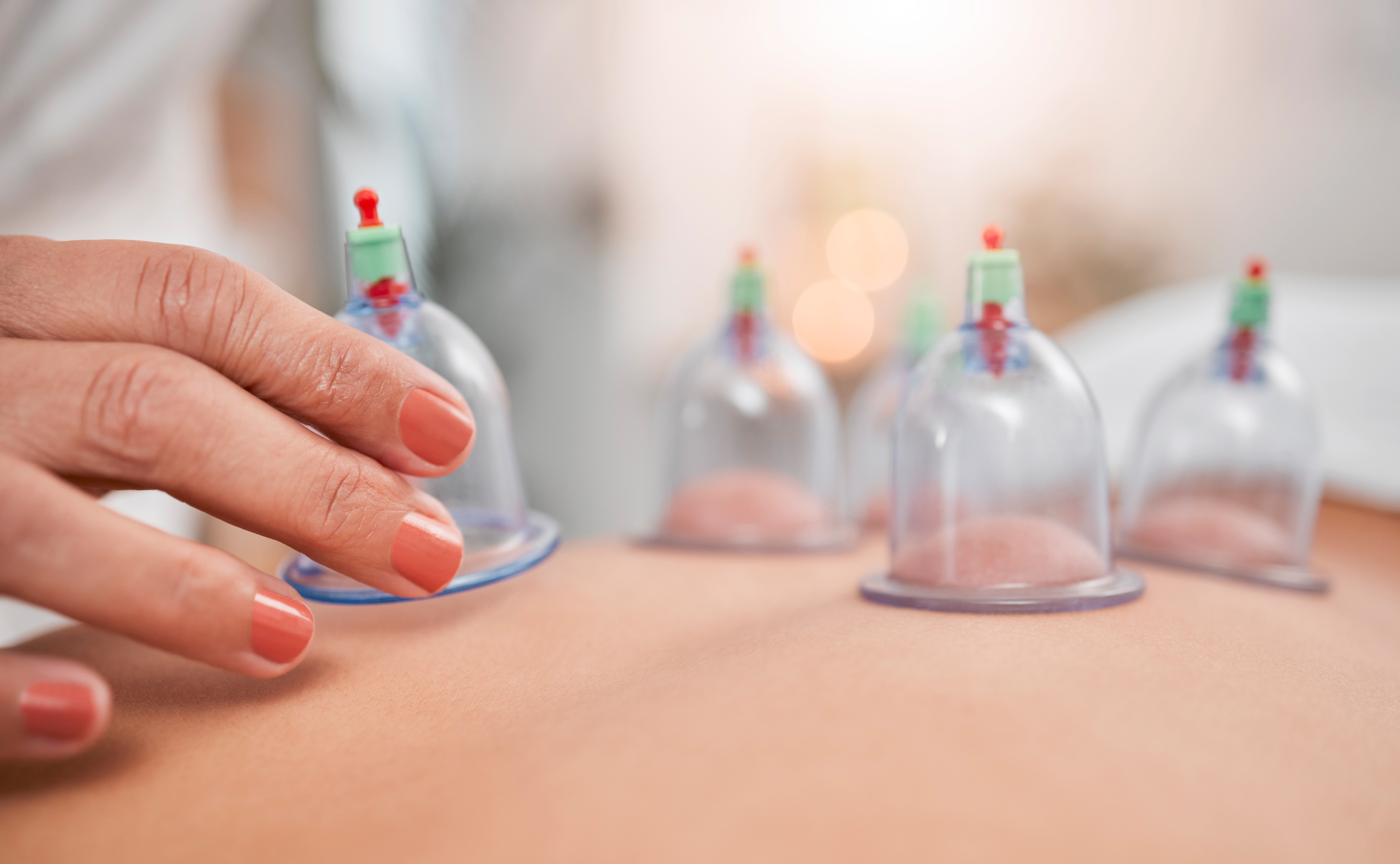 أفضل مواضع الحجامة لتكيس المبايض بالصور