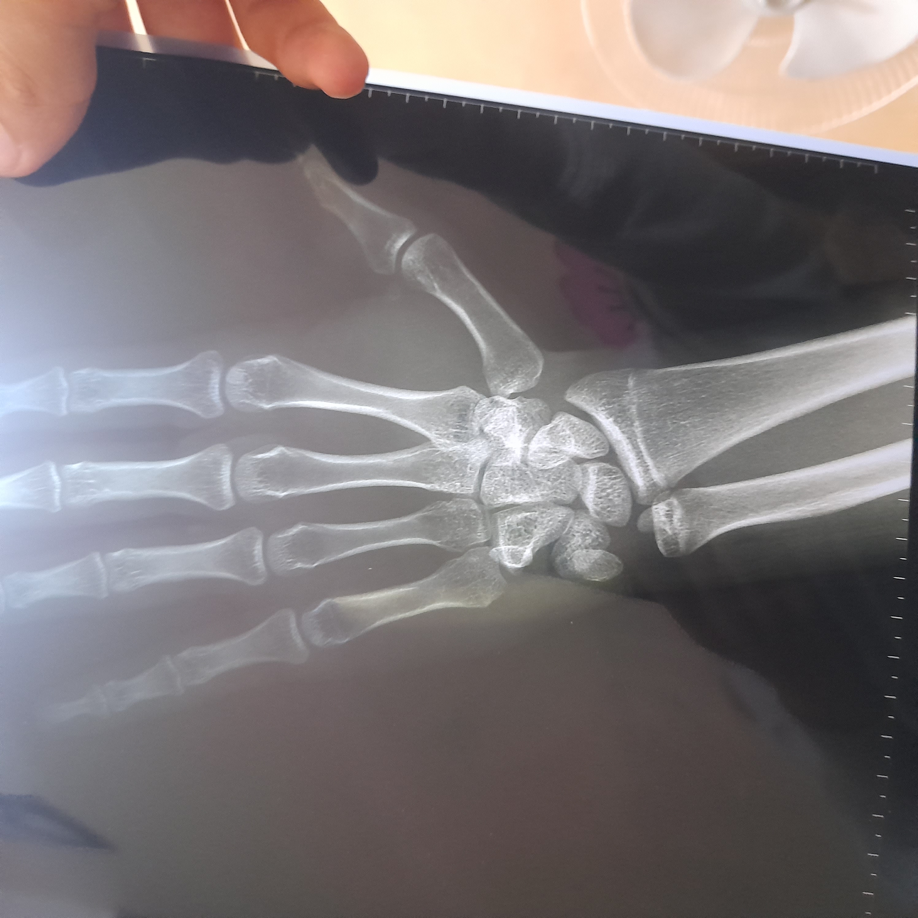 ٢٠٢٥١١١٦_٢٠٠٣٣٣