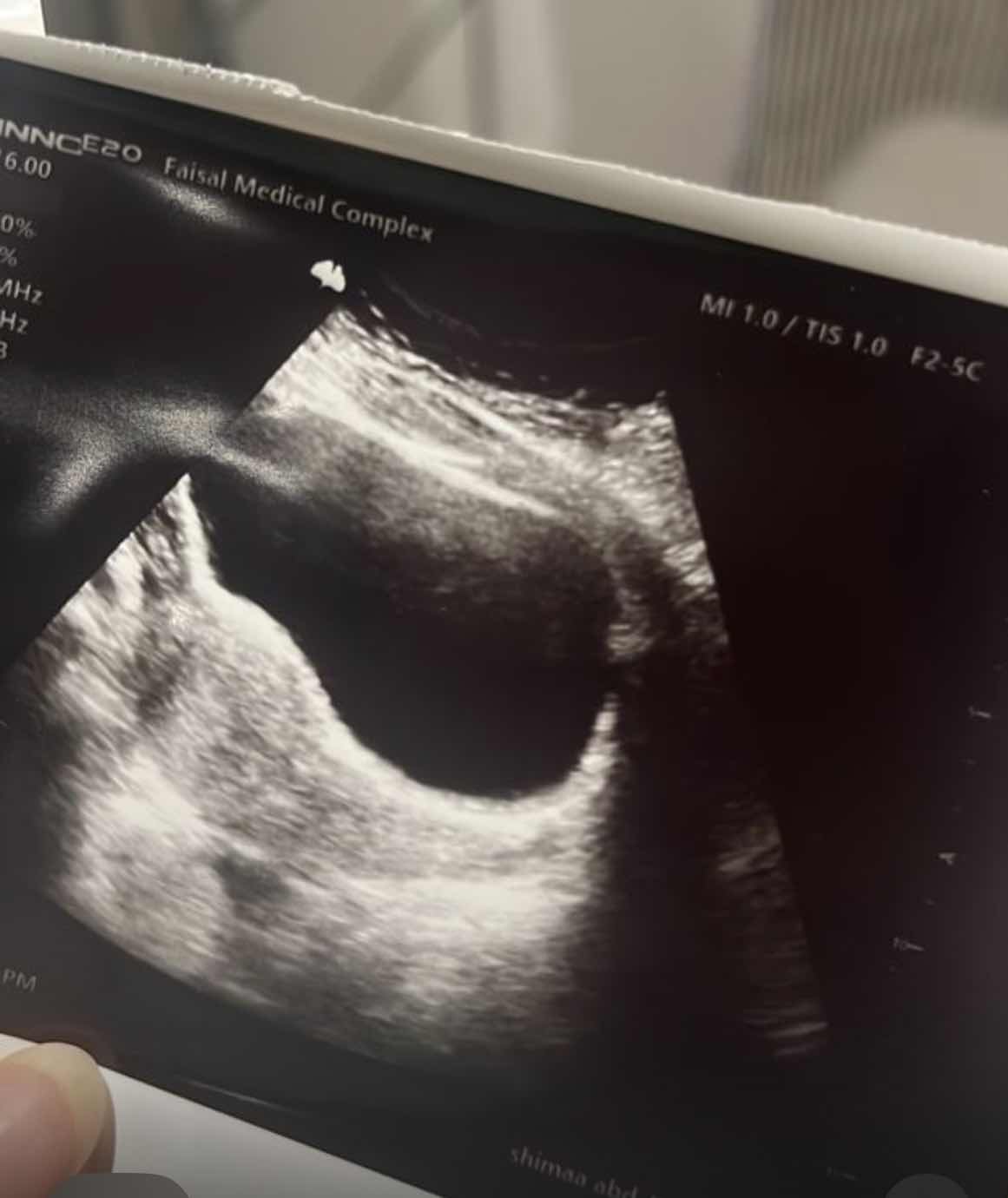 D93F0BEA-193A-4AF0-9483-8A61D2C75175