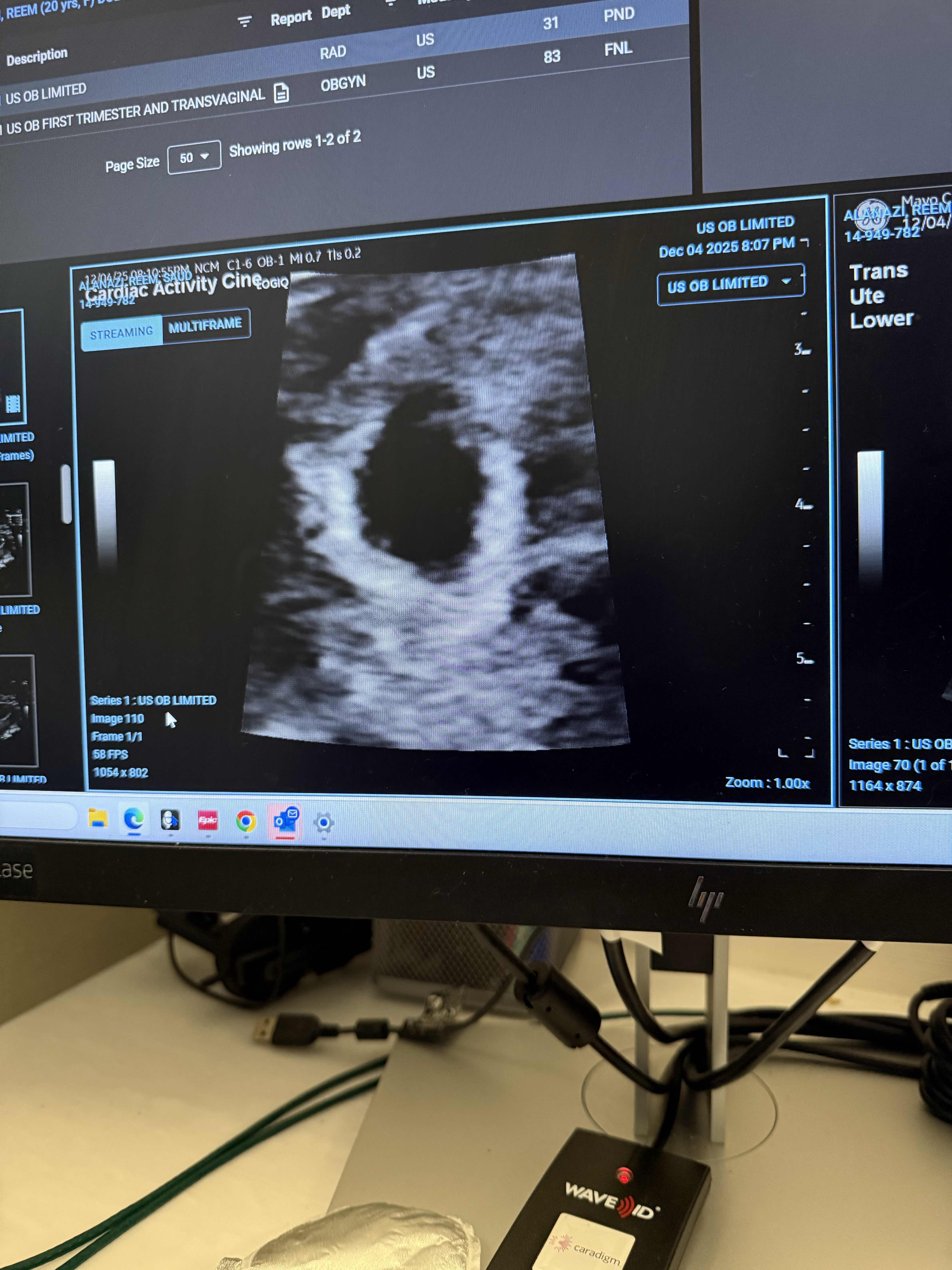 D2633F84-A91D-4A96-8B02-4F13D3BCE005