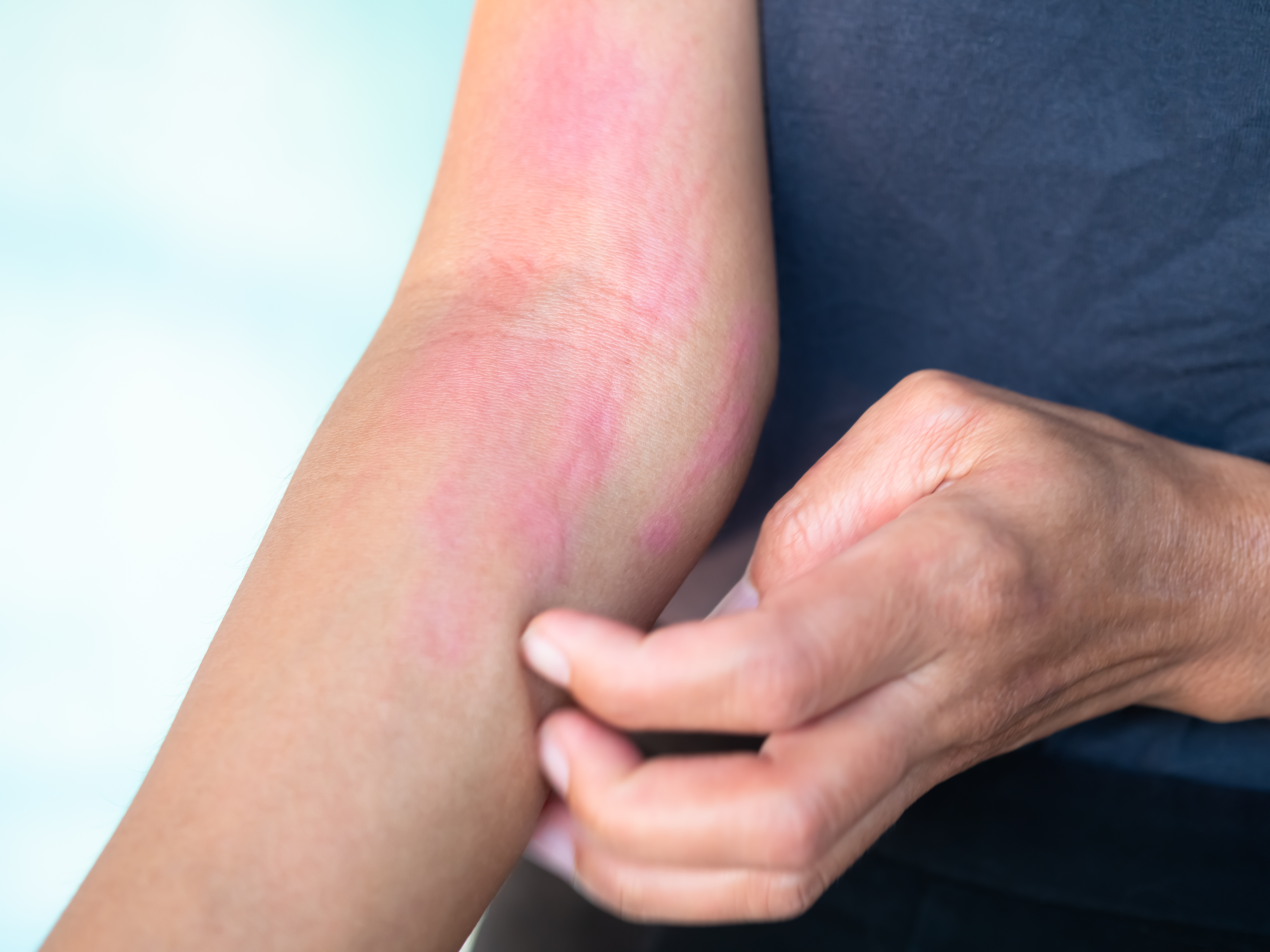 6. أماكن ظهور الأعراض